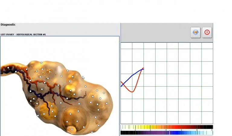 Cómo realizar un análisis profundo de ADN