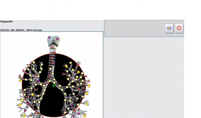 Cómo usar la terapia de partes problemáticas con Metatron NLS 4025 25D
