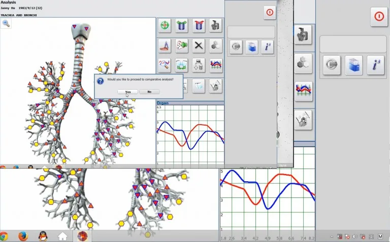 Cómo realizar la prueba Vegeto con el software
