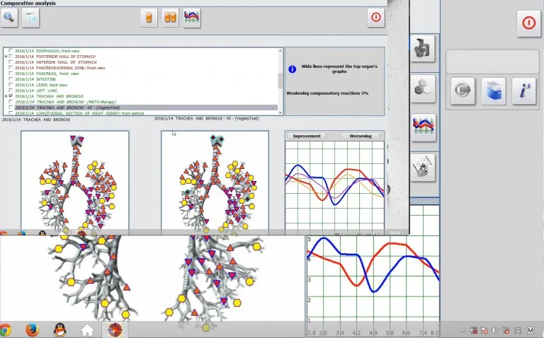 Cómo realizar la prueba Vegeto con el software