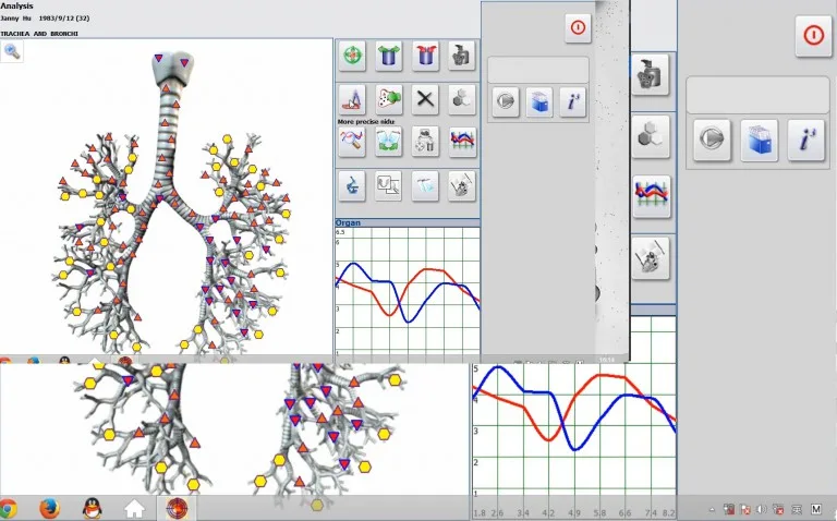Cómo realizar la prueba Vegeto con el software