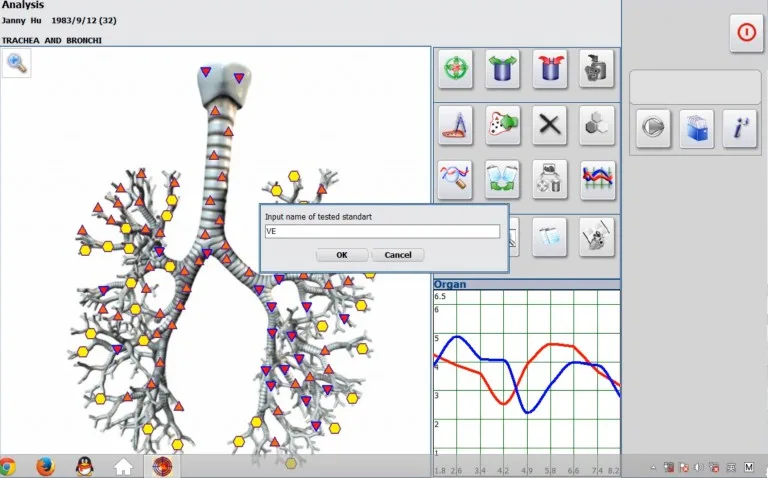 Cómo realizar la prueba Vegeto con el software