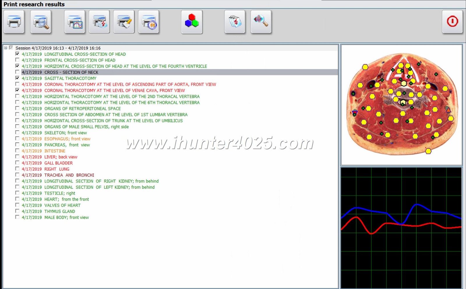 Hunter Metatron 4025