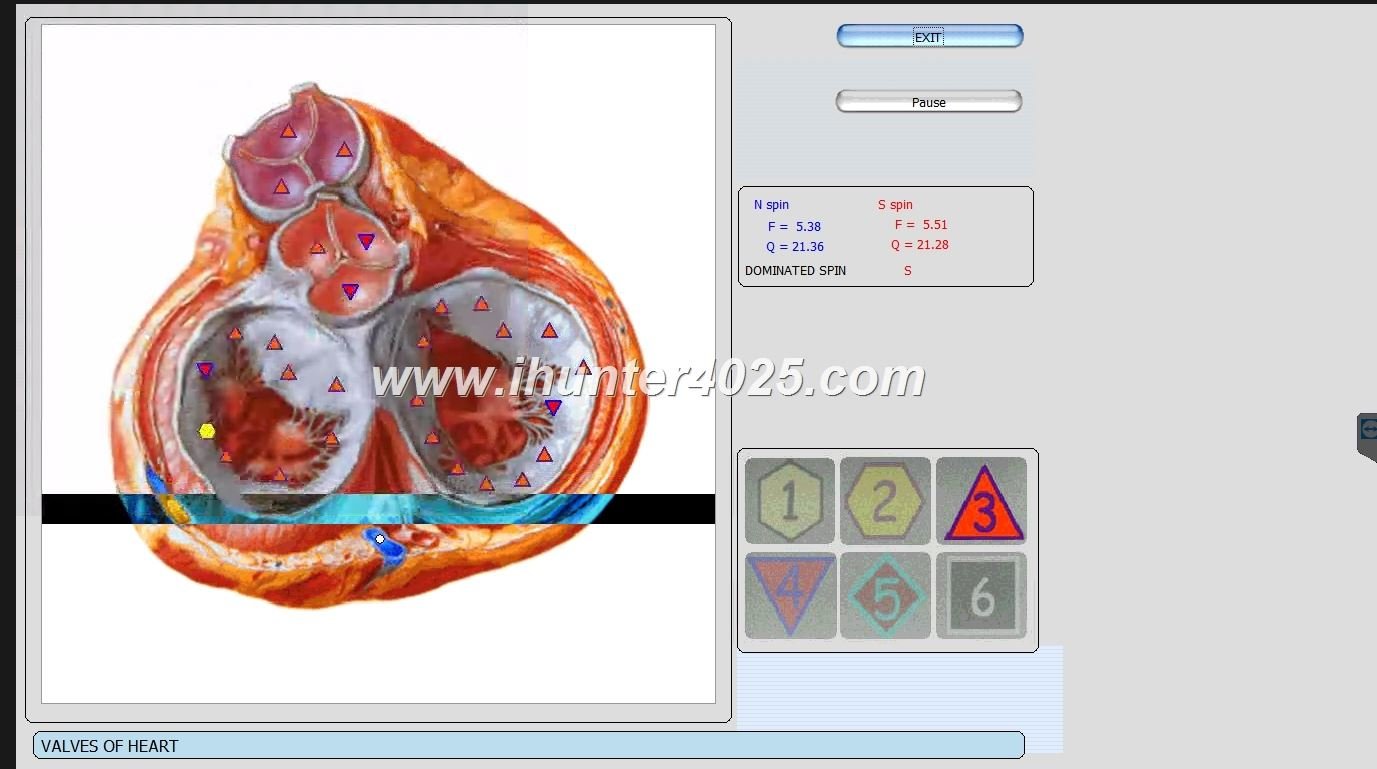 Metatron Hunter Chile