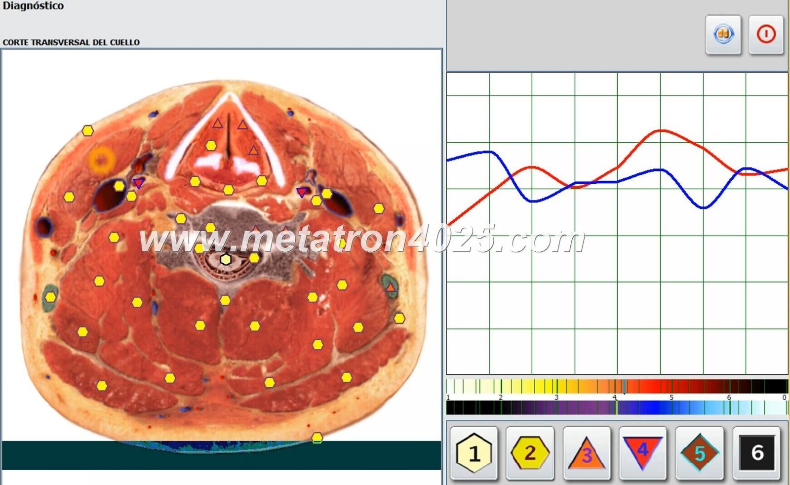 Maikong Metatron Hunter 4025 Scanner: