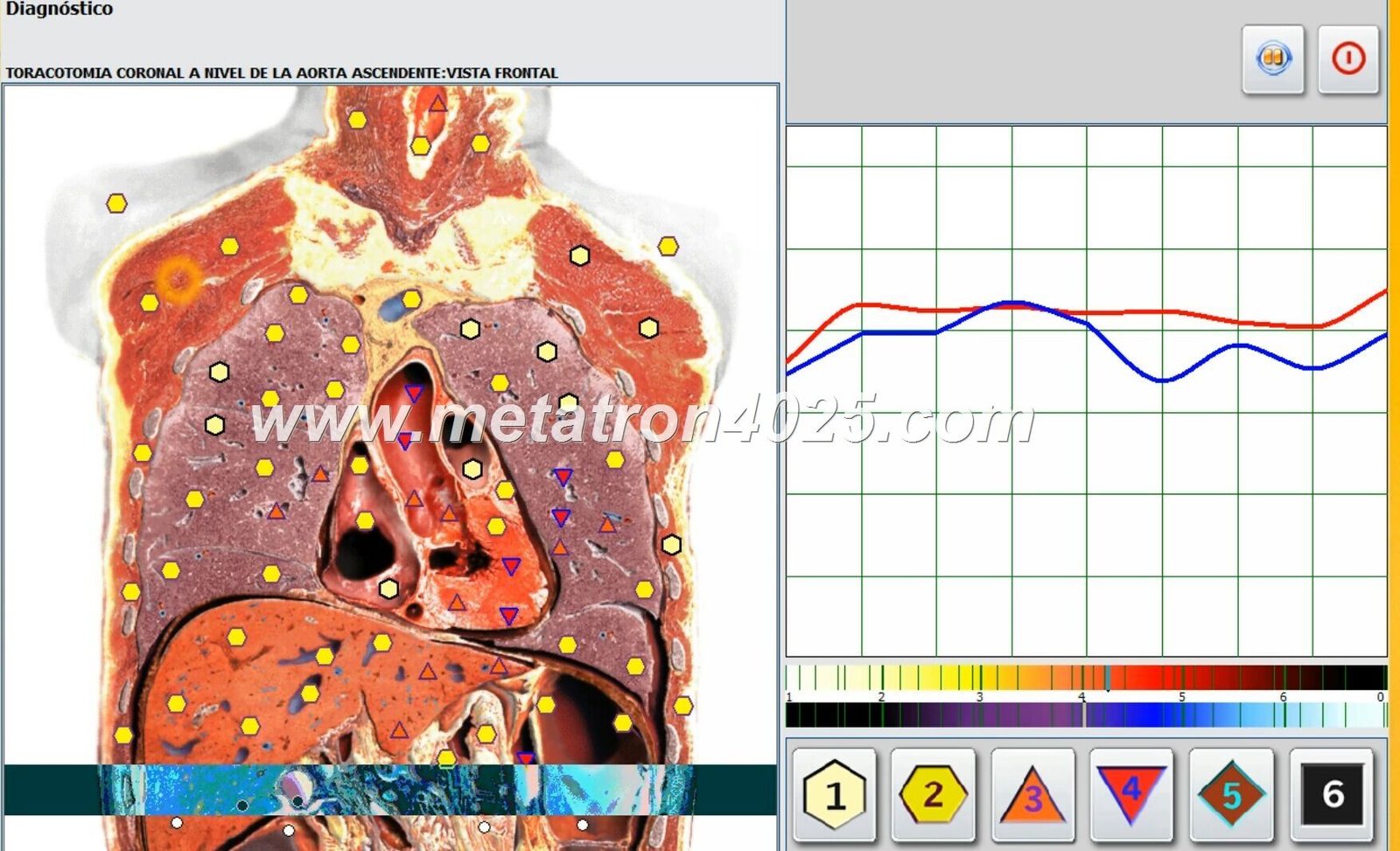 Maikong Metatron Hunter 4025 Scanner: